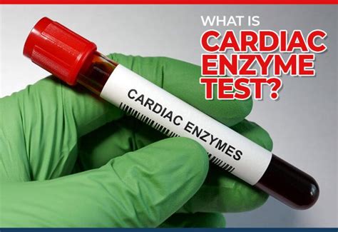 enzime cardiace|Cardiac Enzymes: Test For Heart Attacks and More